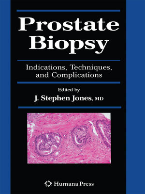 cover image of Prostate Biopsy